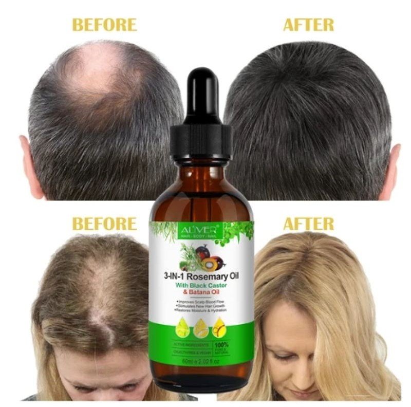 100% Pure Rosemary Oil for Hair Natural Rosemary Oil for Hair Care 4oz