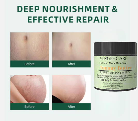 Strecth Mark oil and Tummy  Butter 1oz 30ml