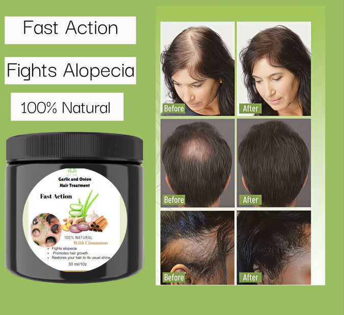 Rosemary Hair Treatment for Hair care 1oz 30mlHair strengthening Treatment | Nourishing & Volumizing