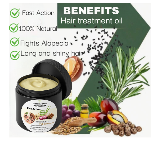 Rosemary Hair Treatment for Hair care 1oz 30mlHair strengthening Treatment | Nourishing & Volumizing
