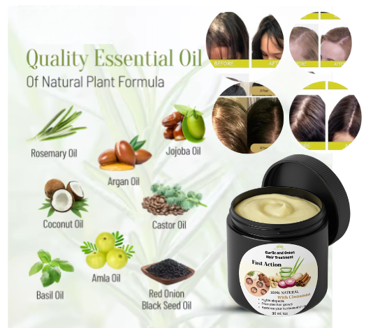 Rosemary Hair Treatment for Hair care 1oz 30mlHair strengthening Treatment | Nourishing & Volumizing