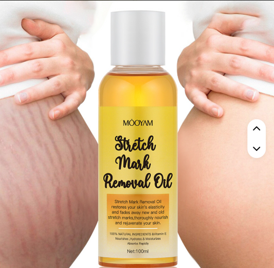Skincare Body Oil, Moisturizer for Scars and Stretchmarks, Hydrates Skin, Non-Greasy, Dermatologist Recommended, Non-Comedogenic, For All Skin Types, with Vitamin A, E,